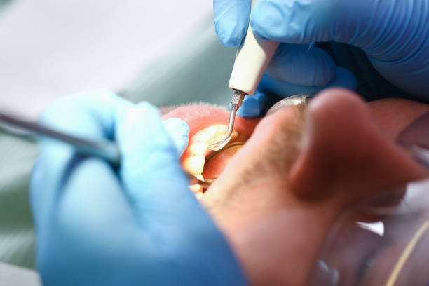 Best Emergency Treatment for Toothache in Crittenden, KY