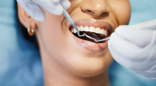 Best Emergency Wisdom Teeth Removal in Crittenden, KY