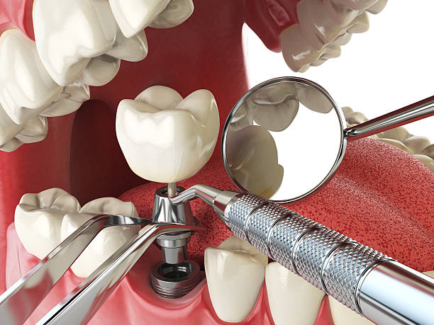 Best Emergency Treatment for Toothache in Crittenden, KY
